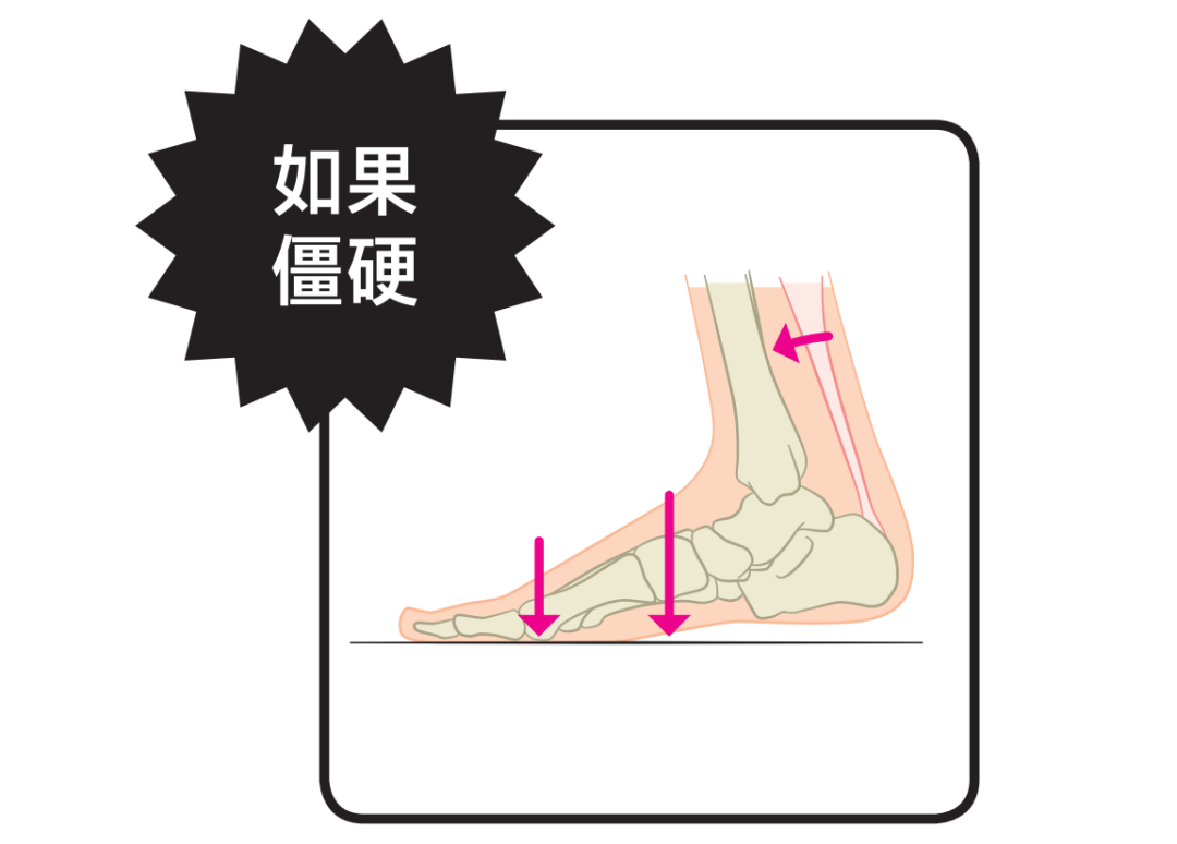 足部专家:"跟腱拉伸"是保持足部年轻的万能药?