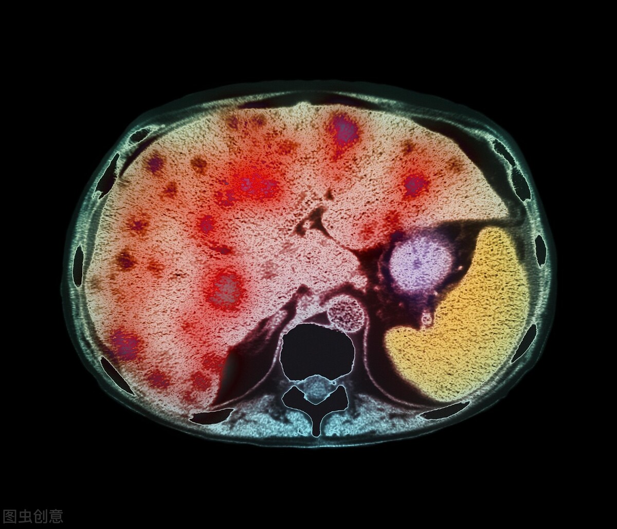 肝腹水晚期能活多久 肝腹水晚期死前症状