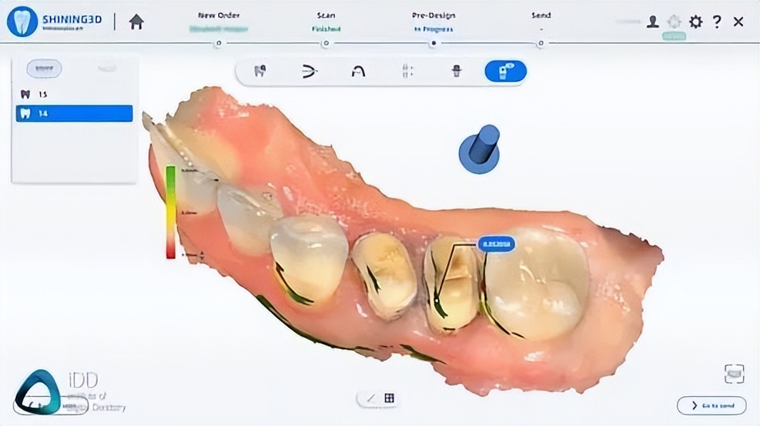 Aoralscan 3软硬件性能强劲，值得入手