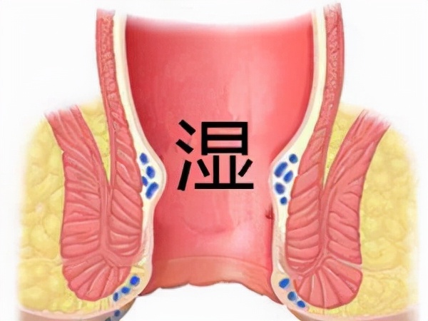 皮肤潮红肿胀，肛周湿疹又痒又痛怎么办？4个治疗方法你要知道