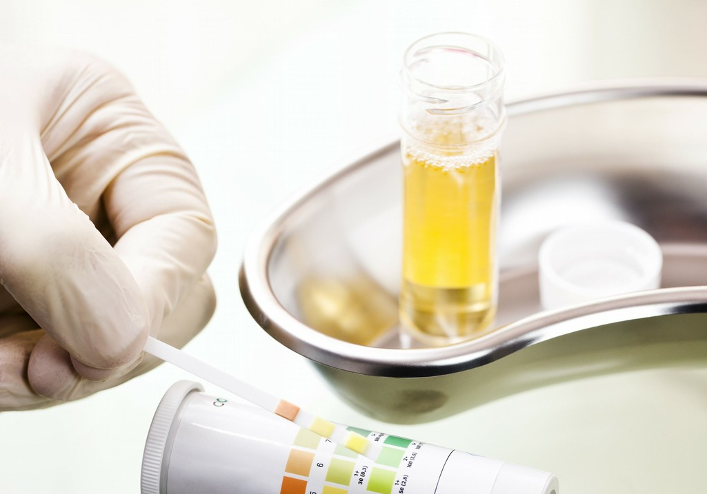 一般来说,正常人的尿里排出的蛋白质每天不超过150ml.