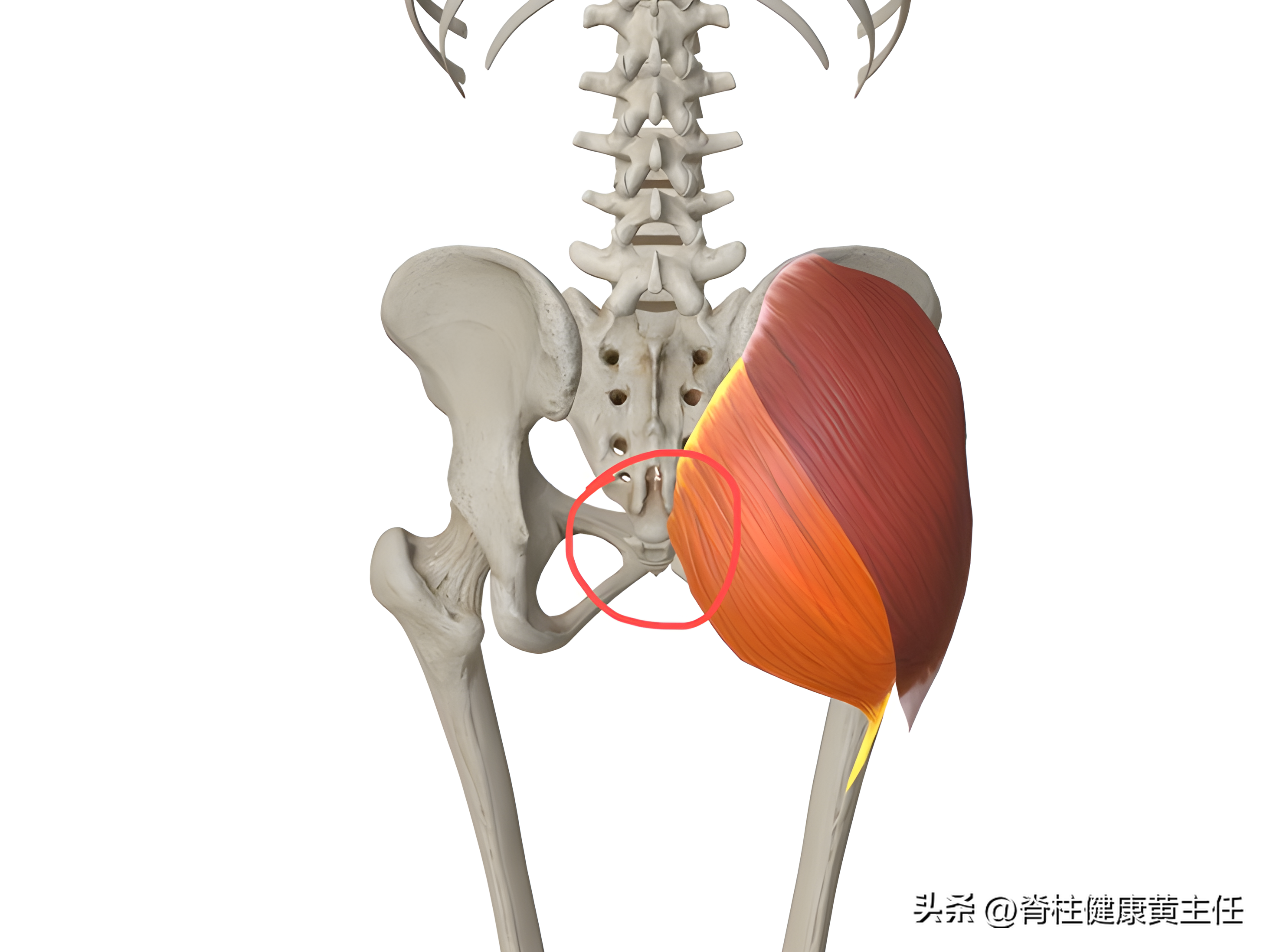 红圈位置为尾骨位置2,臀大肌力量下降,骶结节韧带张力过高导致尾骨