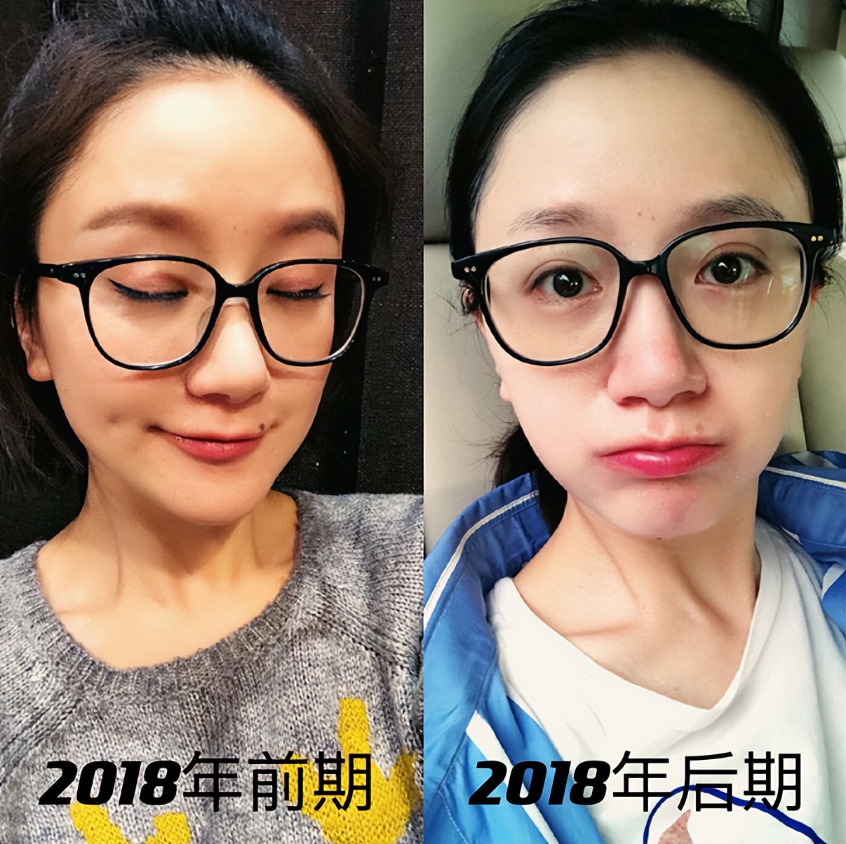 李倩嘴角的这颗痣，到底对她影响多大？