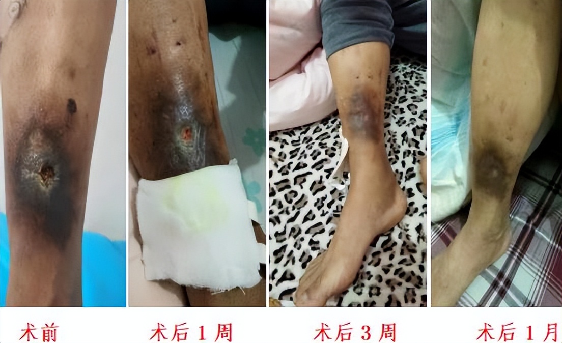 不打烊 更方便 周围血管科（介入科）开设周六全天门诊