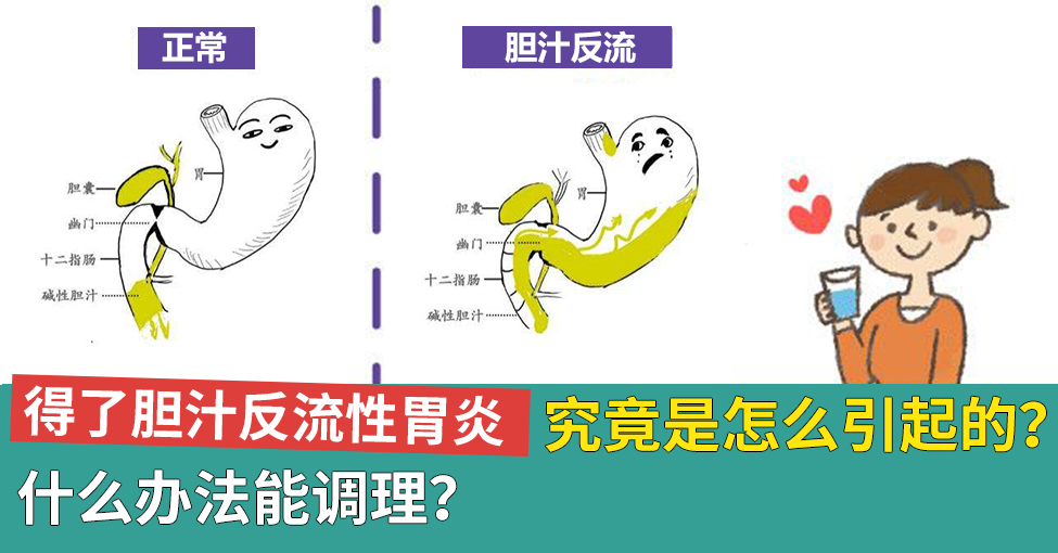 为什么会得胆汁反流性胃炎?究竟是怎么引起的,什么办法能调理?