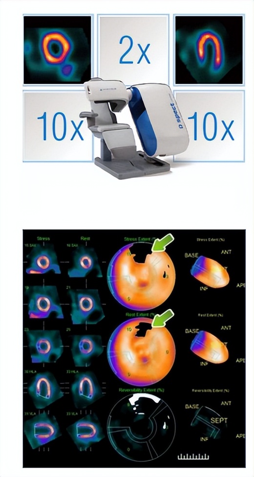 先全面评估(现代心脏功能评估新技术)
