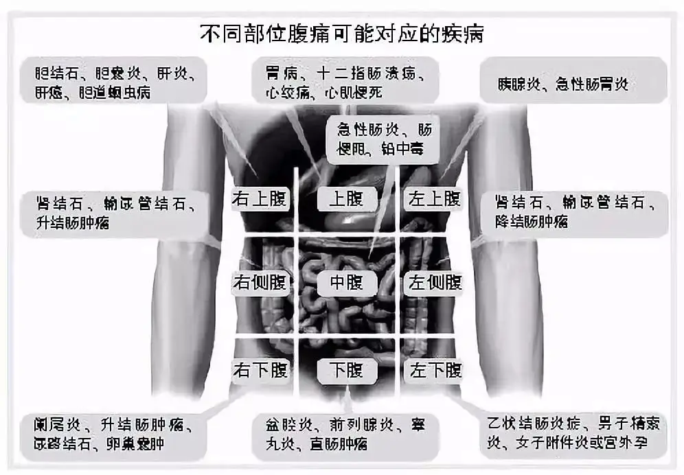 由此可见,单纯的肚子痛可不仅仅是胃疼那么简单