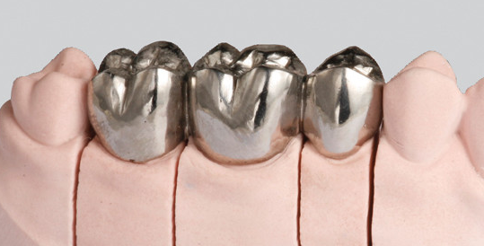 纯钛支架活动义齿图片图片