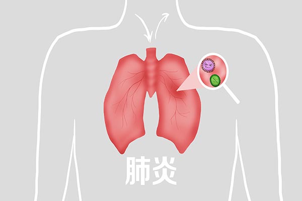 研究表明，新冠肺炎有七成以上住院患者，发病6个月仍有症状