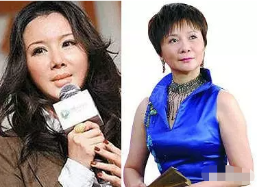 瘦到病态，动脸成瘾，切胃、剪肠齐上阵，内娱的畸形审美真可怕