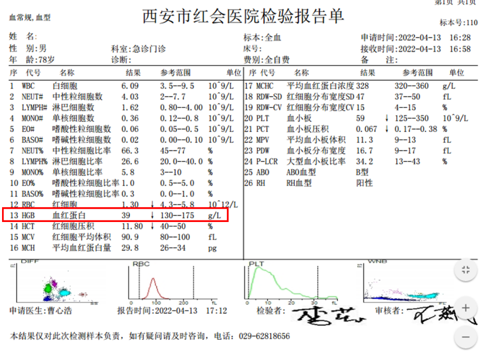 术到病除！消化内科TIPS手术成功救治4名肝硬化晚期患者