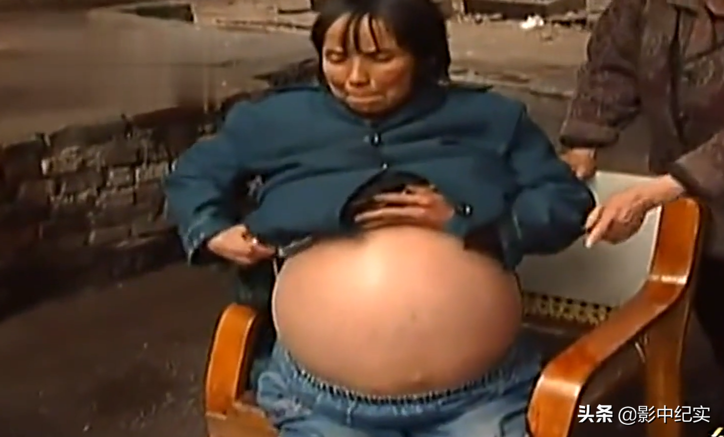 社会人真实拿刀照片(2011年，重庆女子拿刀划开自己肚子，只因自身得了怪病没钱医治)
