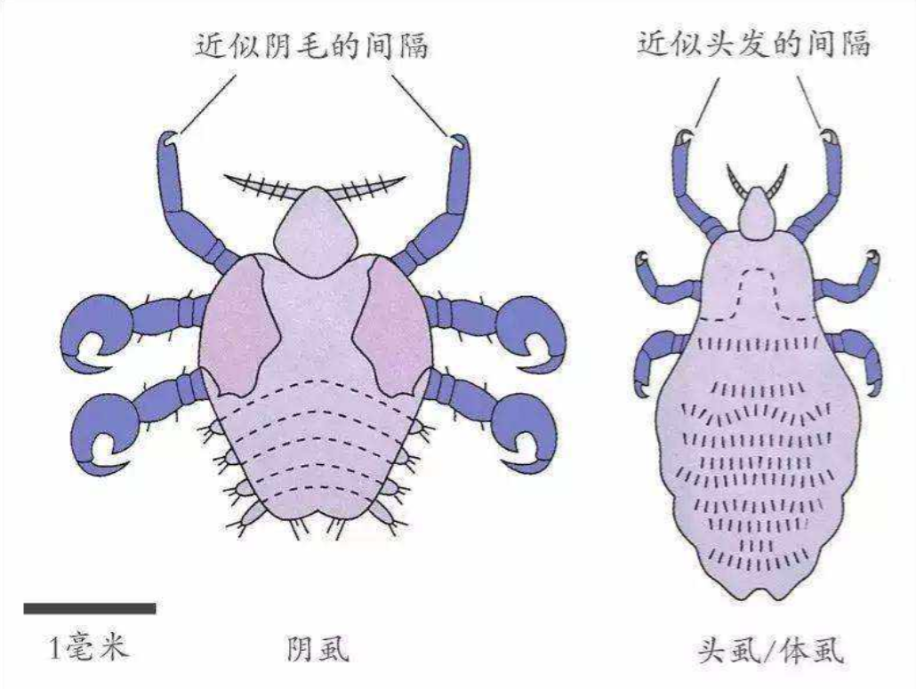 Bret(这是真的！与人类共存，活上千万年了，为何虱子现今很难见到了？)