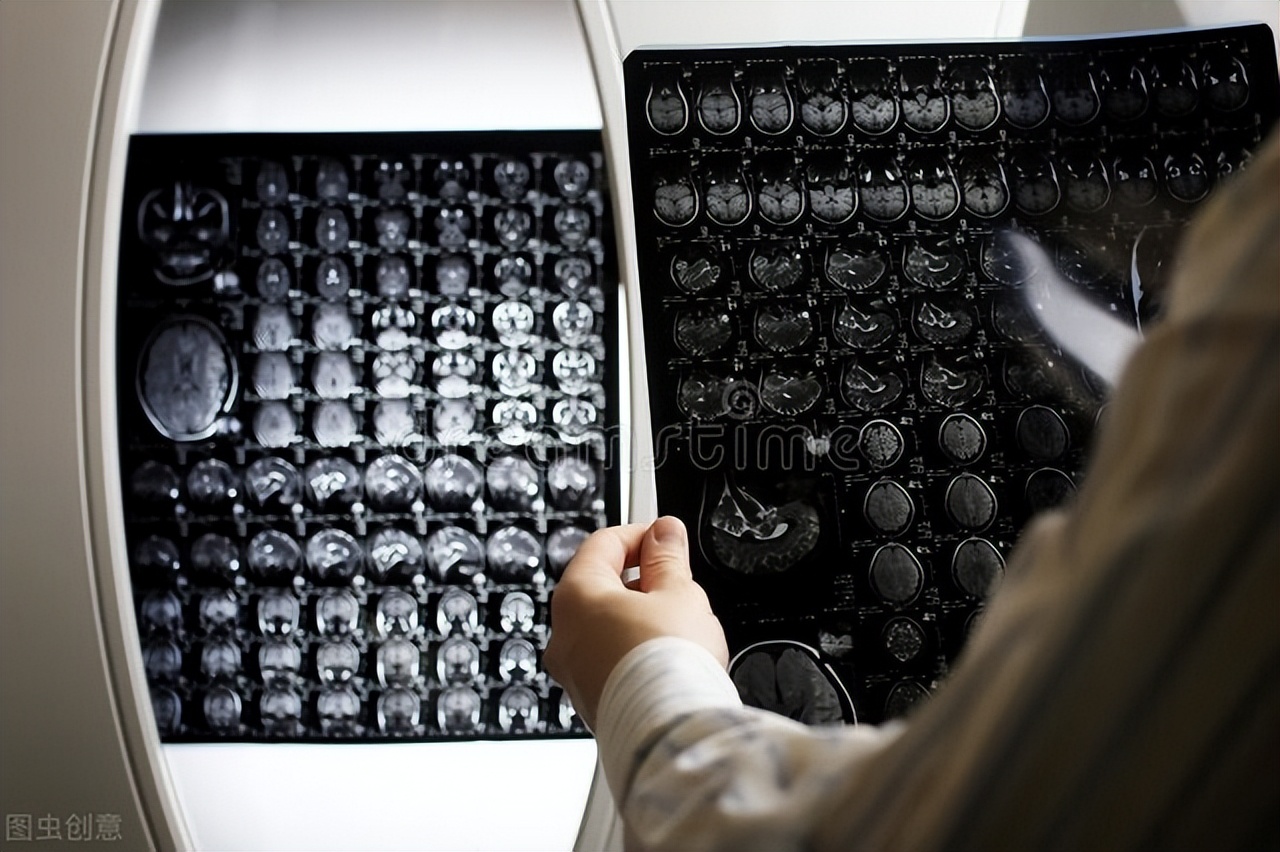 伦琴射线的出现,使得医学获得一个非常大的进步,即:通过透视,就能看到