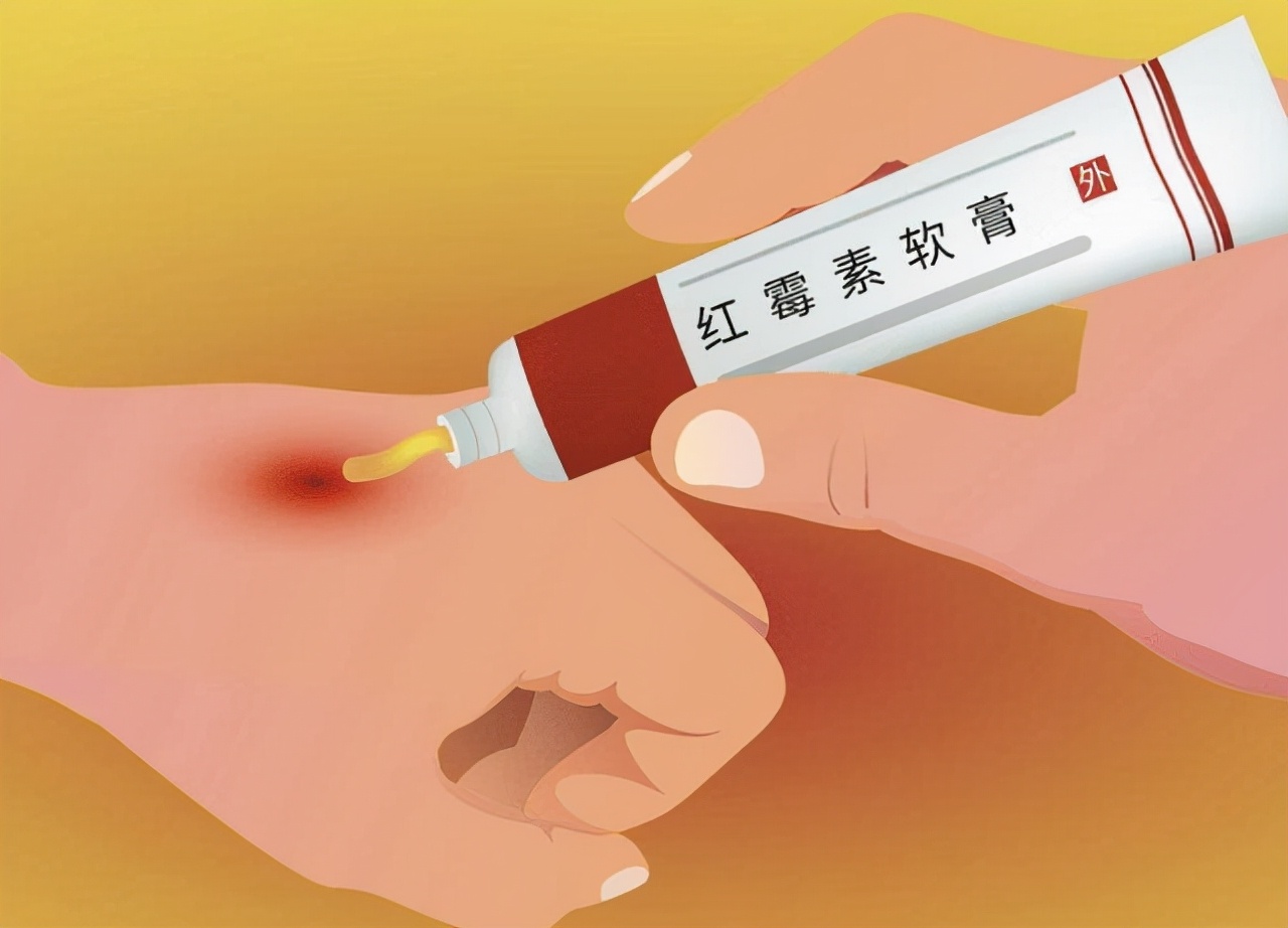 无极膏的功效与作用（一文详解无极膏的药效作用）