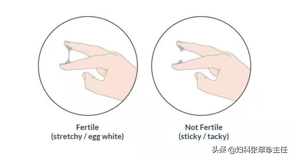 白带化验单到底怎么看？2分钟教会你