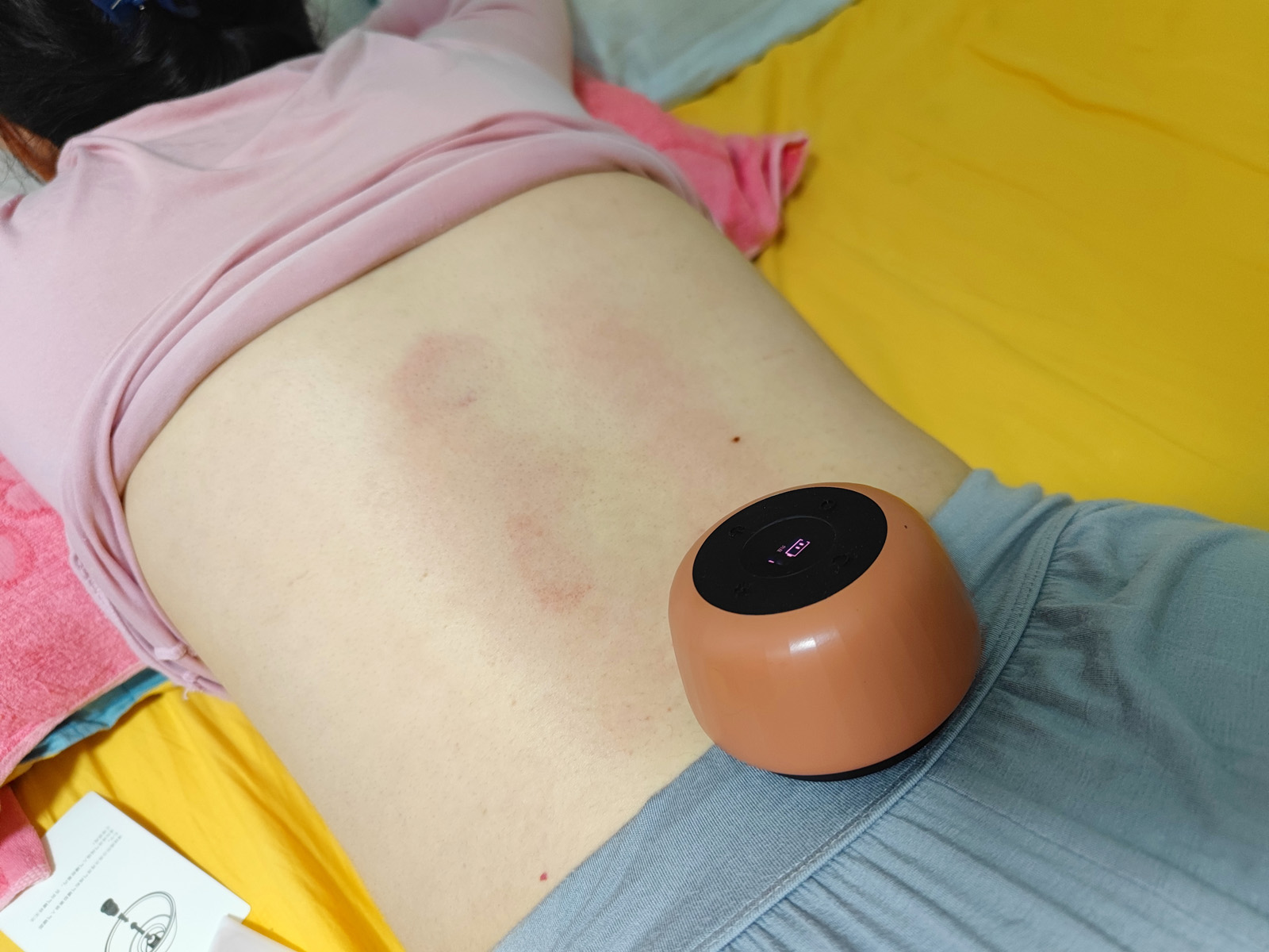 保温杯里泡枸杞，不如走罐健身体！左点走罐按摩器初体验