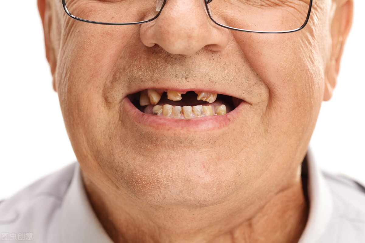 种植牙是怎么样的？哪些人适合种植牙？看下口腔专家怎么说