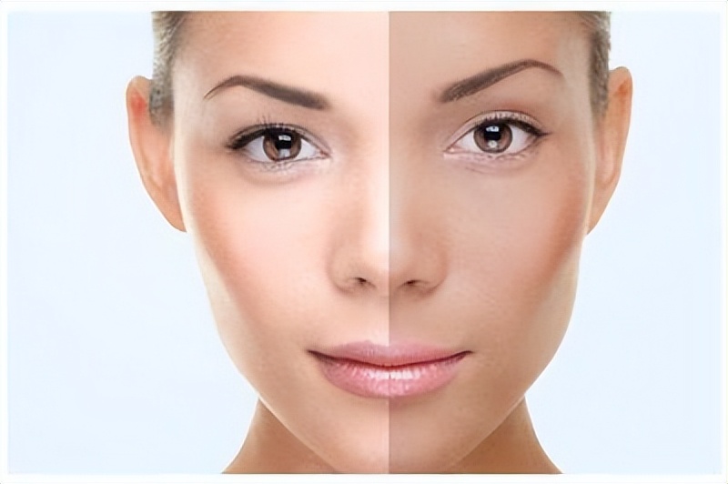 脸是健康的"晴雨表","青红黄白黑"5种脸色,分别代表了什么