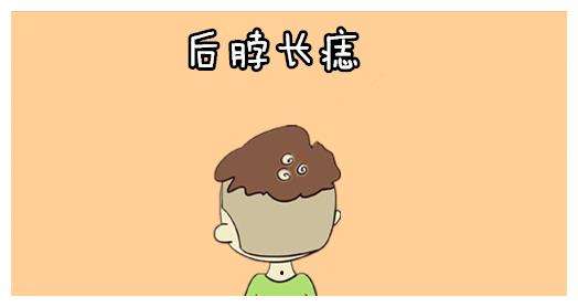 十二星座“痣”的位置，可能一定程度也代表着性格上的特征
