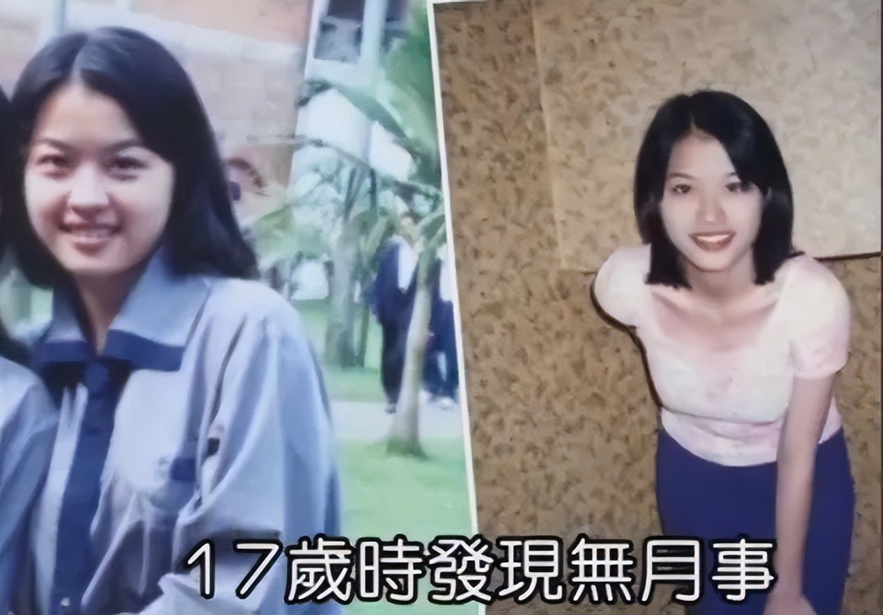 有苦难言的8位明星，多年顽疾缠身，有人成身体缺陷抱憾一生