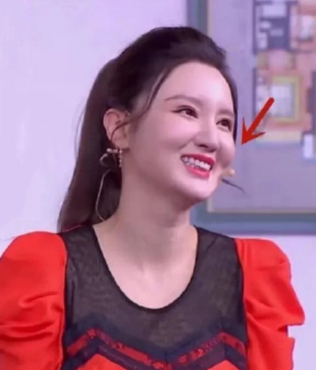 脸部肿成“馒头”，笑起来秒变“僵尸”，这些明星的脸到底咋了？