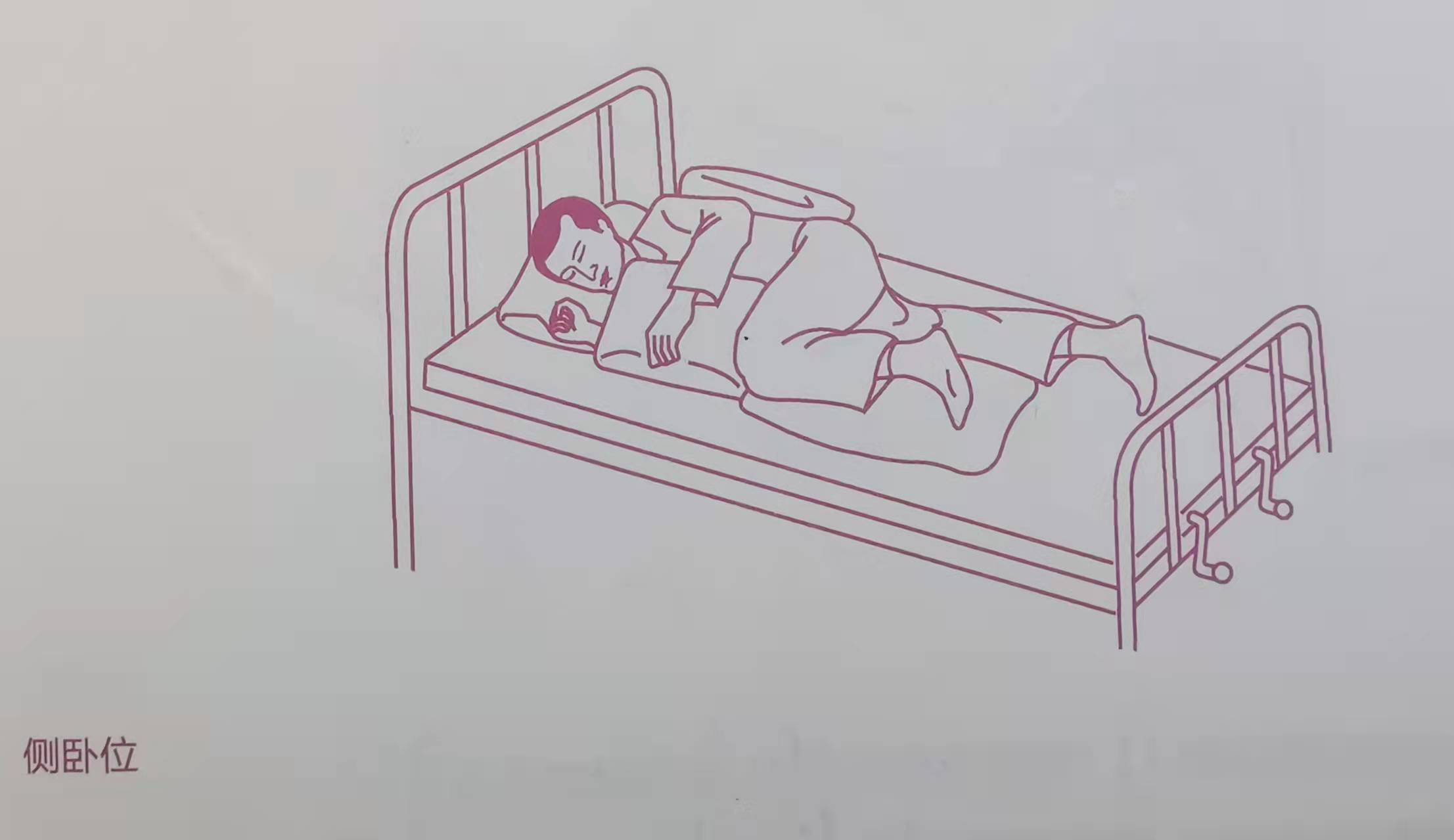 医院常见的卧位