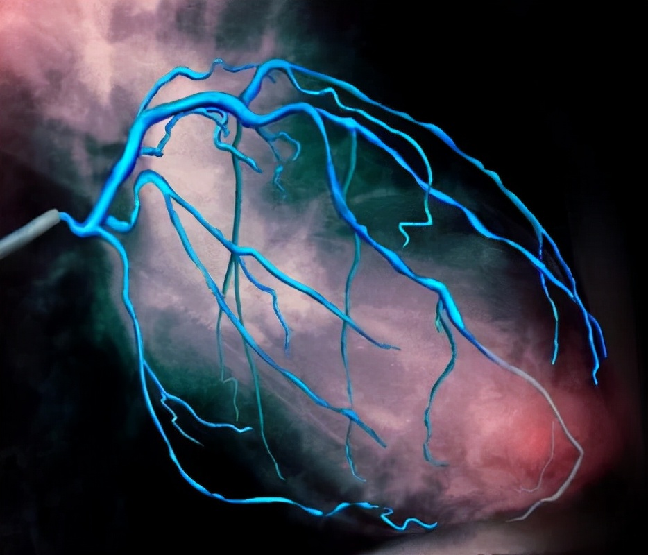 做完冠脉造影，患者就活不久了？劝告：4种人别轻易尝试