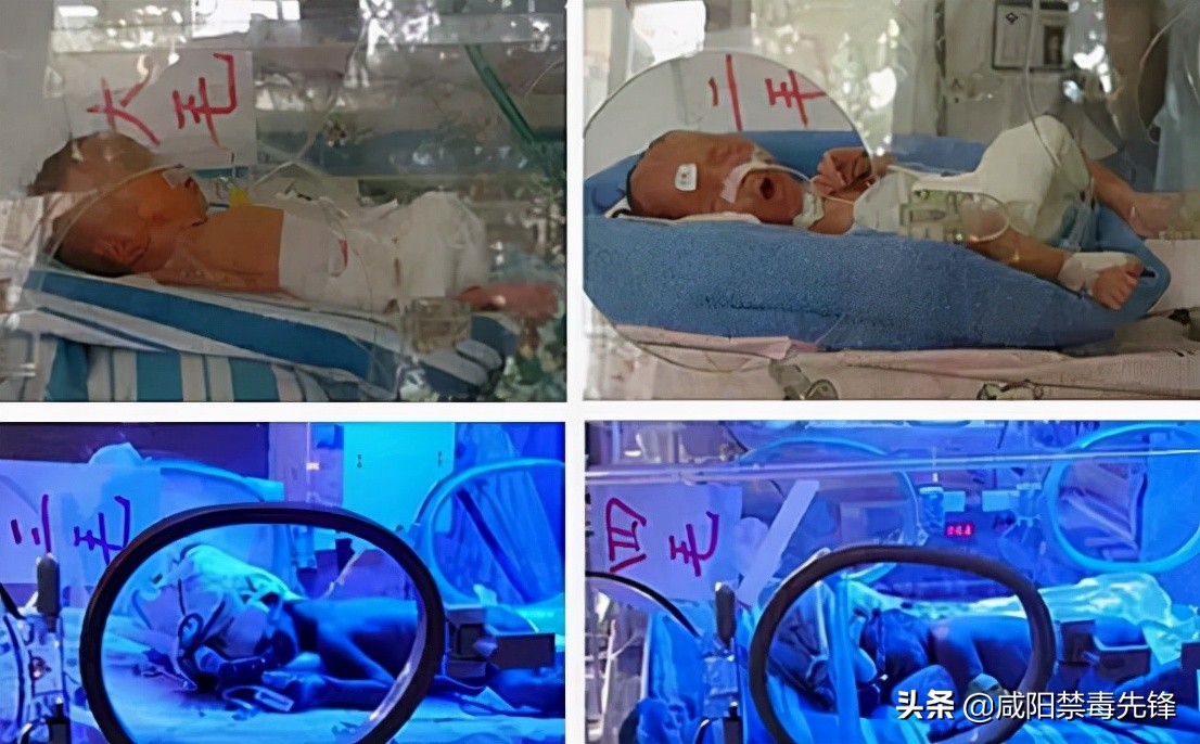 轰动一时的中国首例全男4胞胎：18年前大难不死，18年后金榜题名
