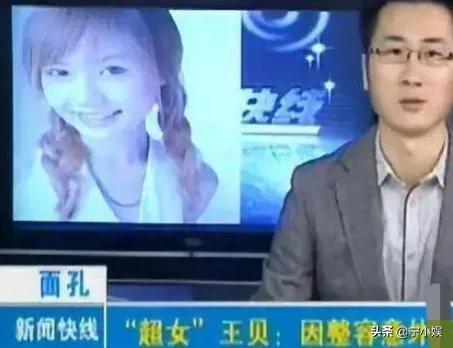 “整容失败”王贝：和母亲一起走上手术台，出事后家人却选择私了
