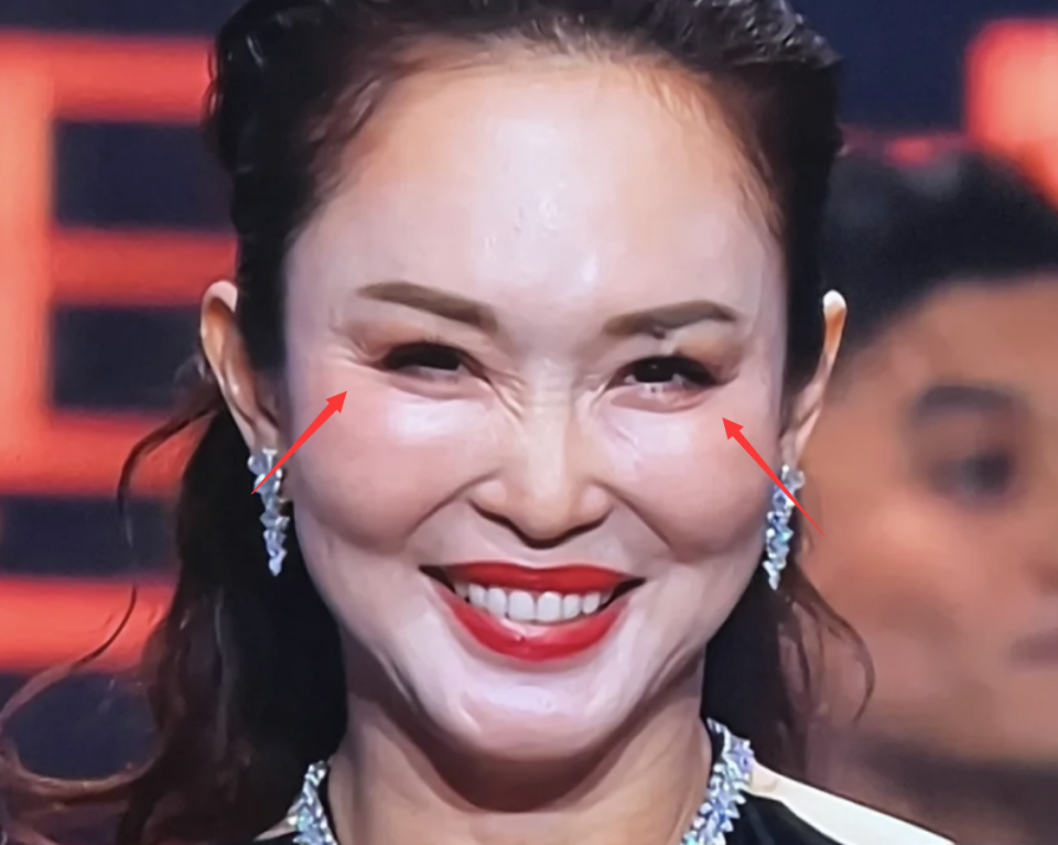 新加坡二美现状:范文芳整容过度脸僵硬,郑惠玉皱纹横生太显老