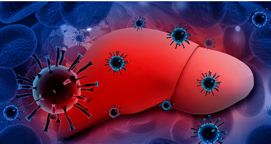 血红蛋白偏高是怎么回事（胆红素偏高说明什么？怎样才能降低胆红素？医生为你解答）