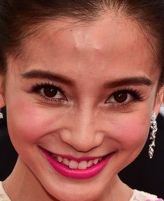 满脸痘,肚子大,皮肤黑!6位生图里的明星,让我看见了人间真实-蘑菇号