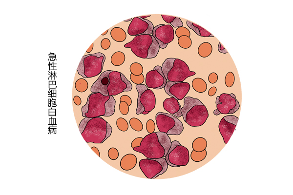 经常染发会致癌？到底是传言还是确有其事？老实跟你说