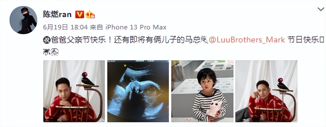 陈燃预产期将至，晒B超照曝二胎是男孩，提前公布宝宝性别惹争议