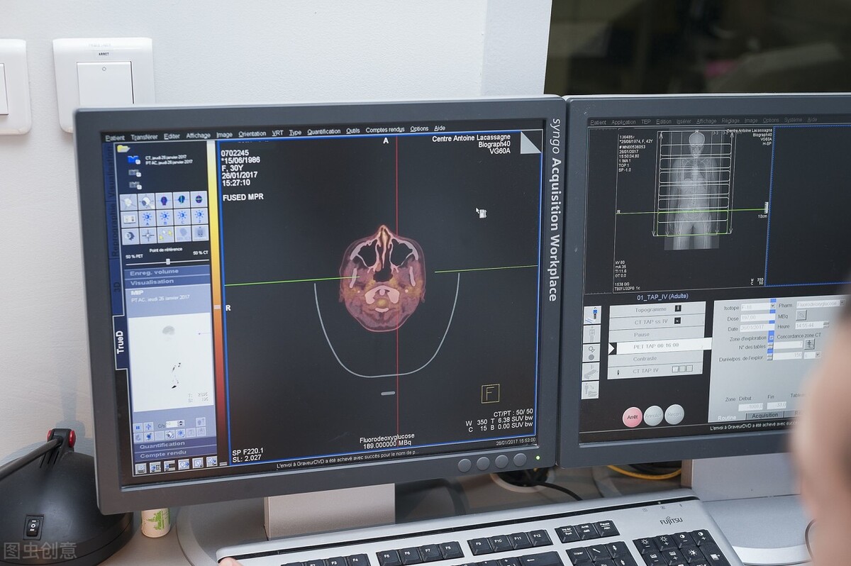 号称“能查出全身90%肿瘤”的PET-CT，为什么医生一般不建议做？