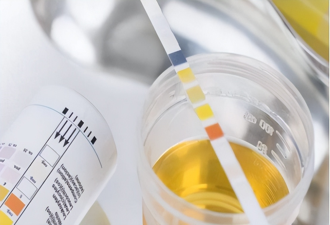 尿液很黄,异味很大?不出意外,可能是这3个原因