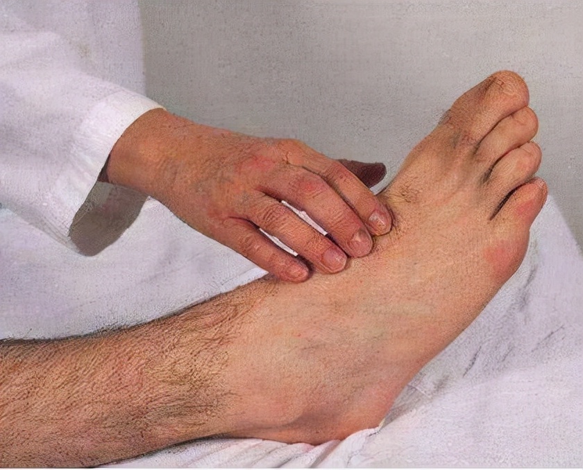 体内有癌，腿部先知？若腿部有这2种异常，或许是要戒备的信号