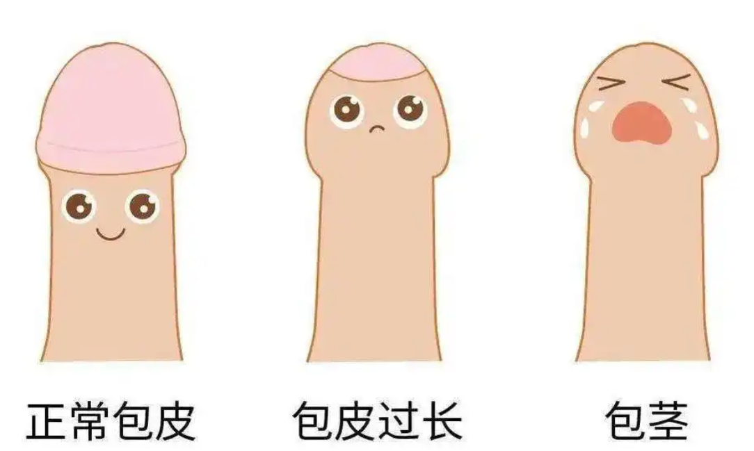 成年男子割包好处和坏处(男性割包皮到底好不好?