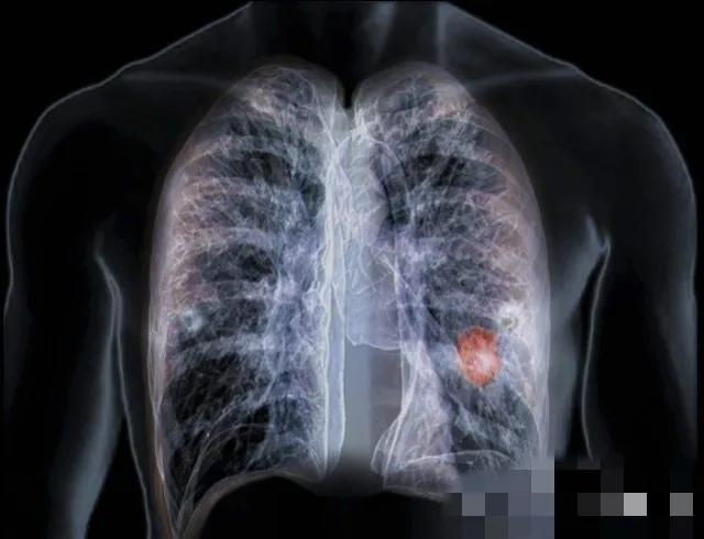 “电焊”到底有什么危害？电焊工：月薪一万五，也吃不起这青春饭