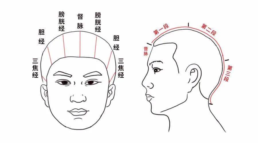 头疼，位置不同，调理的方法也不同，建议收藏