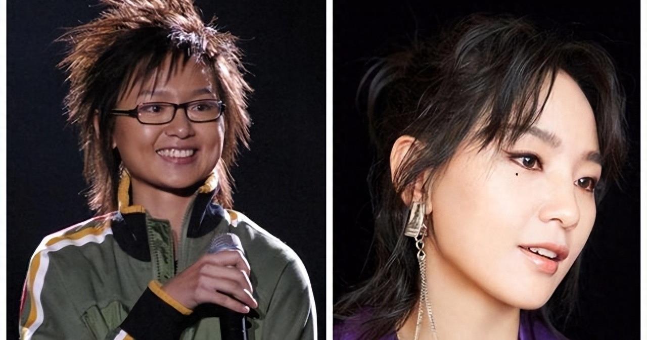 曾是超女冠军,却因整容失败像“怪物”,全身只剩下眼珠是自己的