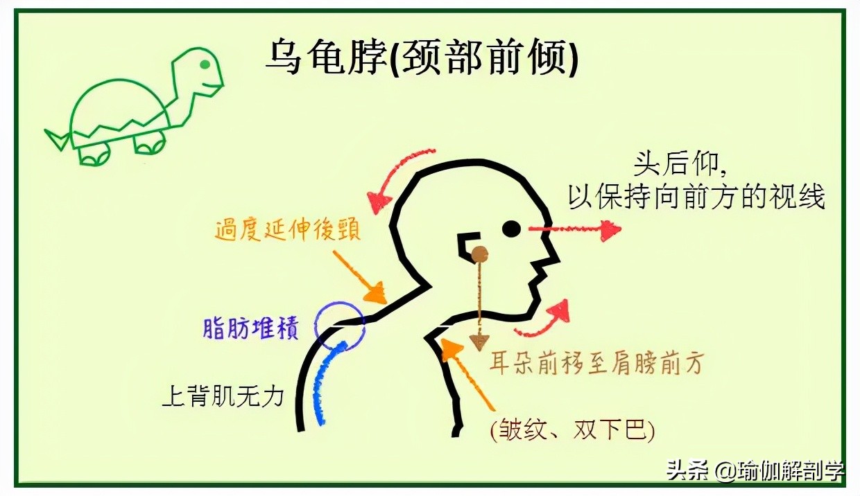 颈椎病锻炼(4个简单的动作每天在家练，改善乌龟脖，理疗颈椎病超级有效)