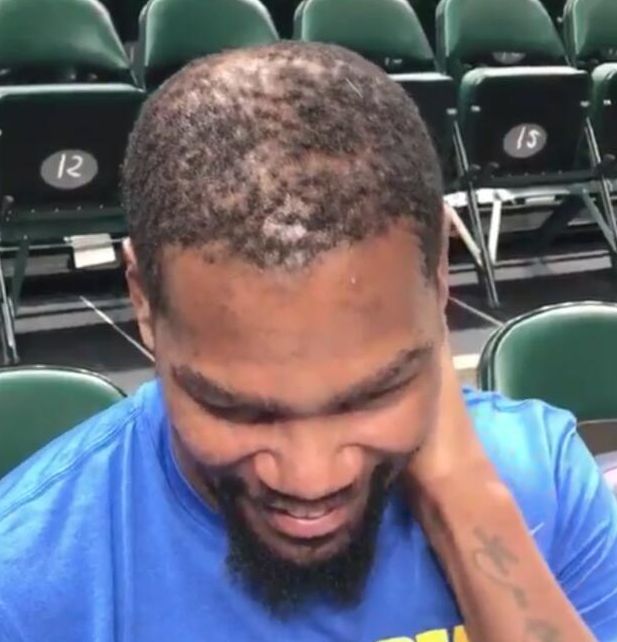 其实从离开雷霆的那个赛季开始,杜兰特就已经有了秃顶的趋势.