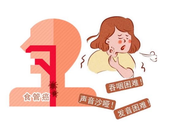以为是慢性咽炎,却查出食道癌?了解两者有何差距