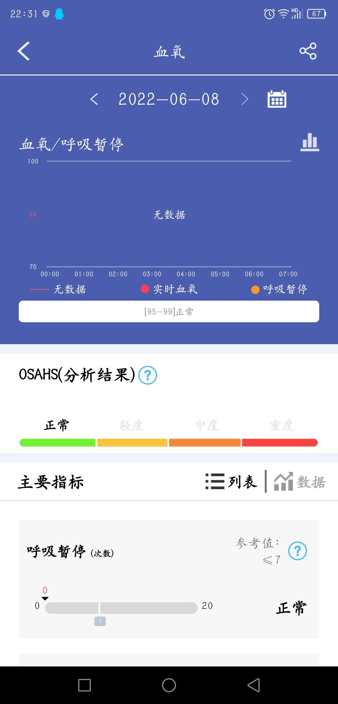 Dido Y1-一款可以智能心电图疾病筛查的智能手环