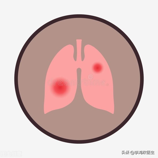 女子腹痛以为胃痛，就诊后医生连下2张病危，家属：能救命的都做