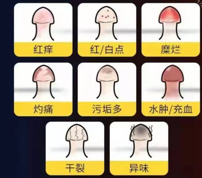 在泌尿外科门诊中,有相当一部分时间要关注在男性的隐私部位,有些看似