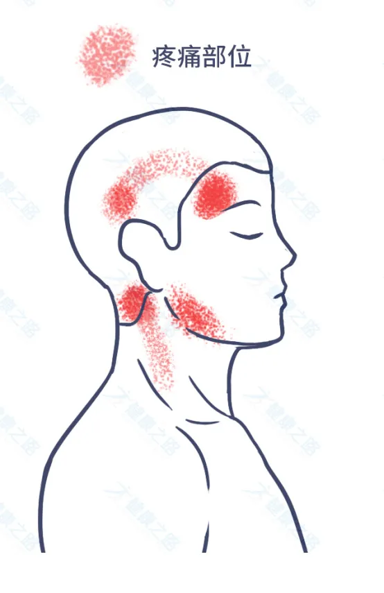 1个马上缓解头痛的方法，简单有效，还能预防颈椎病