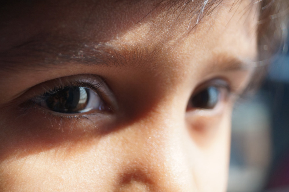 孩子注意力不集中,眼神涣散,眯眼或者歪头视物……听听眼科医生怎么说